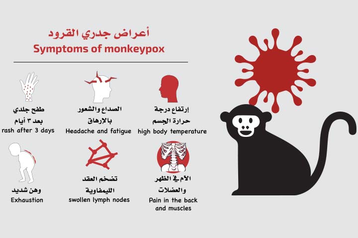 «جدري القرود».. ما هو وكيف يمكنك الوقاية منه؟